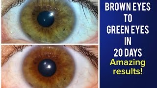 Brown Eyes to Green Eyes in 20 days Using Quadible Integrity AMAZING RESULTS [upl. by Emelita]