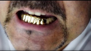 Fitting Bottom Teeth Grillz [upl. by Hakvir]