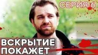 🔪 Сериал ВСКРЫТИЕ ПОКАЖЕТ  1 сезон  6 СЕРИЯ [upl. by Hplodur]