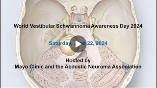 Tumor microenvironment and implications for vestibular schwannoma care [upl. by Mauve]