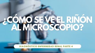 ¿QUÉ ES LA BIOPSIA RENAL ¿CUÁNDO SE PIDE ¿CÓMO SE HACE Diagnóstico renal parte 4 [upl. by Harwill]