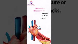 Congestive Heart Failure Causes Symptoms and Treatment Options  Dr Sudheer Koganti shorts [upl. by Azarria881]