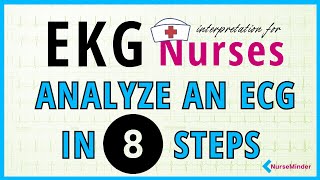 How to Read an ECG  ECG Interpretation  EKG  OSCE Guide  UKMLA  CPSA  PLAB 2 [upl. by Ennazus]