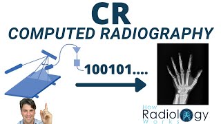 Computed Radiography How it Works CR Image Receptor [upl. by Ahsiekal]