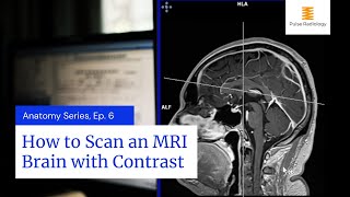 How to Scan an MRI Brain with Contrast [upl. by Sass]