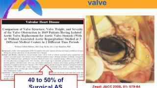 Periprocedural guidance and detection of complications in TAVI [upl. by Bernardi]