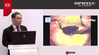 Comparison between Artiflex Toric and limbal relaxing incisions for correcting myopic astigmatism [upl. by Datha817]