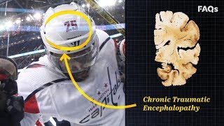 CTE Why this brain disease is more common than you think [upl. by Notyalc]