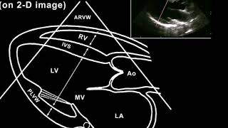 Echocardiography for beginners  the best [upl. by Rebliw]