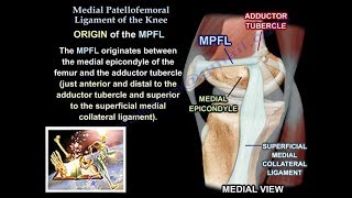 Medial Patellofemoral Ligament Of The Knee Anatomy Everything You Need To Know  Dr Nabil Ebraheim [upl. by Ahsiekat]