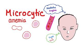 Microcytic Anemia introduction [upl. by Akcir190]