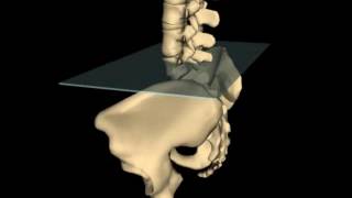 Posterior Innominate Rotation [upl. by Adyan]