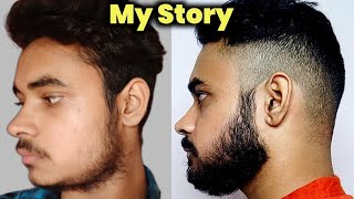 My Story Patchy Beard To Full Beard Naturally  Fix Patchy Beard Naturally  Beard Growth Reality 😯 [upl. by Nawak]