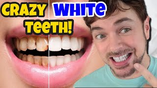 Get CRAZY WHITE Teeth  Best Teeth Whitening Products That Work  Chris Gibson [upl. by Lait]