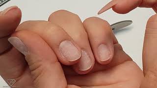 Nail Anatomy cuticle nail fold eponychium hyponychium Nails and allergic reactions [upl. by Eileme]