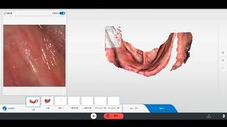 Scan fully edentulous with Primescan [upl. by Buff]