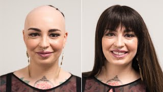 Real hair wig instead of baldness  Help with alopecia areata  Hairsystems Heydecke [upl. by Anana]