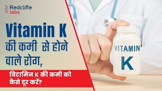 Vitamin K की कमी से क्या होता है Vitamin K Deficiency in Hindi  विटामिन K की कमी को कैसे दूर करें [upl. by Becket689]