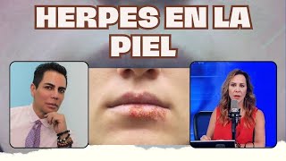 IDENTIFICA los DIFERENTES tipos de HERPES en la PIEL I JAVIER DERMA [upl. by Enelram50]