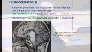 Taenia solium cysticercosis Life cycle epidemiology and diagnosis Dr L Odendaal [upl. by Anibur]