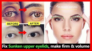 5 exercises Fix Sunken upper eyelids hollow upper eyelids Make firm and volume no filler [upl. by Greenburg668]