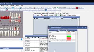 Open Dental Scheduling with Appointment Types [upl. by Gothart669]