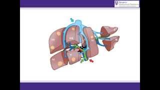 ALPPS procedure animation  A surgical solution for initially unresectable liver tumours [upl. by Marigold]