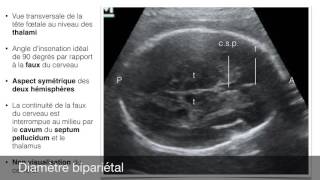 Biométrie fœtale [upl. by Yllom]