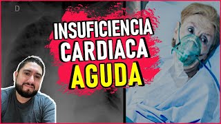 INSUFICIENCIA CARDIACA AGUDAABORDAJE EMERGENTE BY DR ZAMARRÓN [upl. by Murrell]