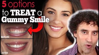 5 OPTIONS TO TREAT A GUMMY SMILE  Doctors Advice [upl. by Eisserc]