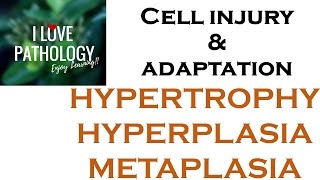 Cell Adaptations pathologyHYPERTROPHY HYPERPLASIA AND METAPLASIA [upl. by Kristine]