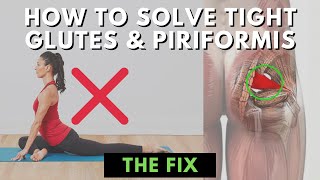 The Root Cause of Tight Glutes amp Piriformis [upl. by Monty]