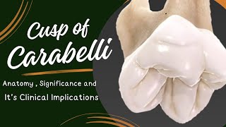 “Understanding the Cusp of Carabelli Anatomy Significance and Clinical Implications” [upl. by Bucella916]