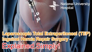 Laparoscopic Total Extraperitoneal TEP Inguinal Hernia Repair Surgery  Explained [upl. by Aivitnahs]