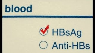 What does HBsAg positive means  HBsAg positive symptoms  HBsAg positive treatment [upl. by Eninahpets805]