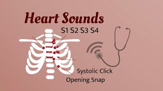 Heart Sounds S1 S2 S3 S4  Systolic Click Opening Snap With audio of Heart Sounds [upl. by Beera]