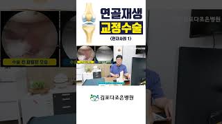 연골재생 관절수술 [upl. by Anayet]