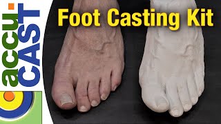 Foot Drop Test How to Diagnose Peroneal Nerve Injury at Home in 5 Easy Steps [upl. by Nahtnahoj494]