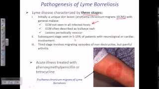 Lyme disease by borrelia [upl. by Tavish325]