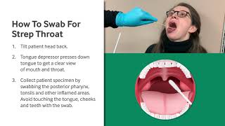 How to Swab for Strep Throat [upl. by Pine909]