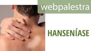 Webpalestra  Hanseníase diagnóstico precoce na ABS [upl. by Nosila13]