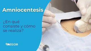 🫃Amniocentesis ¿qué es y para qué sirve esta prueba diagnóstica [upl. by Dnalerb]