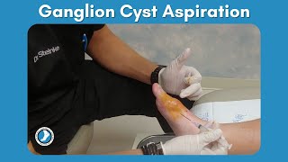 Ganglion Cyst Aspiration [upl. by Hayarahs]