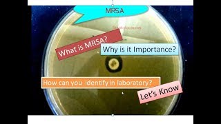 MRSA  Methicillin Resistant Staphylococcus aureus [upl. by Suciram]