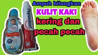 Cara Cepat Sembuhkan Kulit Kaki Kering Dan Pecah Pecah [upl. by Karyl]