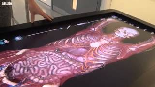 Virtual surgery How to dissect a digital cadaver [upl. by Ednew]