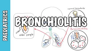 Bronchitis or Pneumonia How to Tell the Difference [upl. by Erv286]