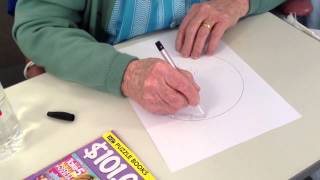 Clock Drawing Test in parietal stroke [upl. by Anabel]