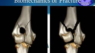 Elbow fractures in dogs [upl. by Bolten321]