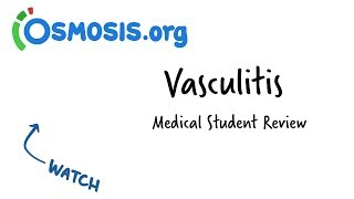 Vasculitis  Clinical Presentation [upl. by Lundeen]